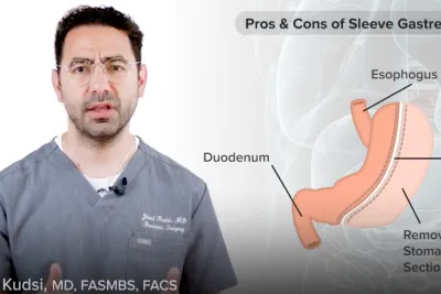 Pros & Cons of Sleeve Gastrectomy with Dr. Jihad Kusdi, MD, FASMBS, FACS