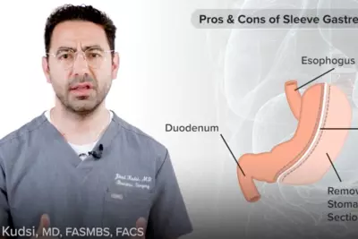 Pros & Cons of Sleeve Gastrectomy with Dr. Jihad Kusdi, MD, FASMBS, FACS