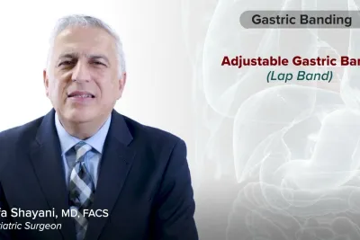 Procedure Overview: Gastric Banding (Lap Band) with Dr. Vafa Shayani