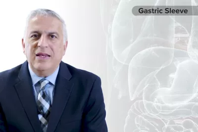 Procedure Overview: Gastric Sleeve with Dr. Vafa Shayani