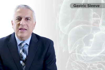 Procedure Overview: Gastric Sleeve with Dr. Vafa Shayani