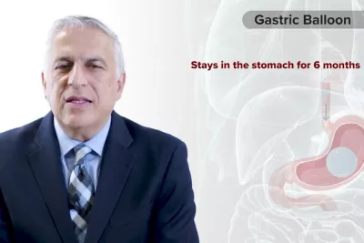 Procedure Overview: Gastric Balloon with Dr. Vafa Shayani