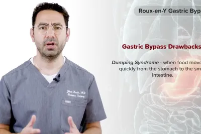 Procedure Overview: Roux-en-Y Gastric Bypass with Dr. Jihad Kudsi