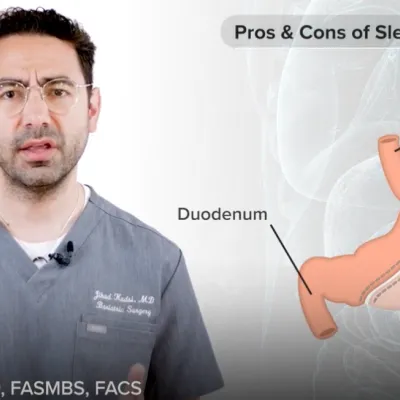 Pros & Cons of Sleeve Gastrectomy with Dr. Jihad Kusdi, MD, FASMBS, FACS