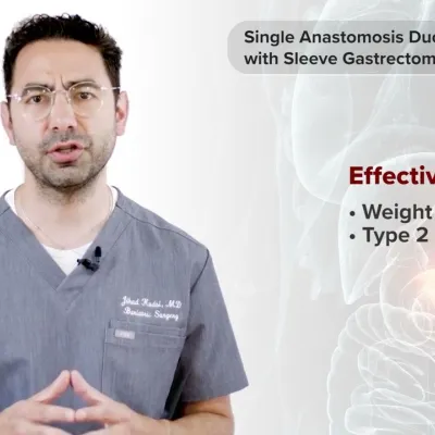 Single Anastomosis Duodeno-Ileal Bypass with Sleeve Gastrectomy (SADI-S) with Dr. Jihad Kudsi