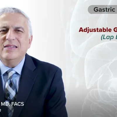 Procedure Overview: Gastric Banding (Lap Band) with Dr. Vafa Shayani