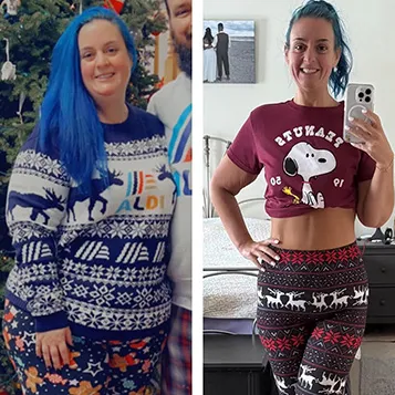 Michelle Wajda before and after Bariatric Surgery.