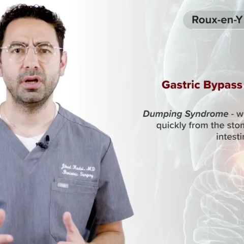 Procedure Overview: Roux-en-Y Gastric Bypass with Dr. Jihad Kudsi