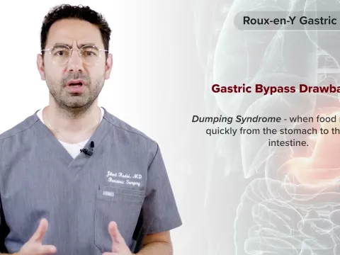 Procedure Overview: Roux-en-Y Gastric Bypass with Dr. Jihad Kudsi