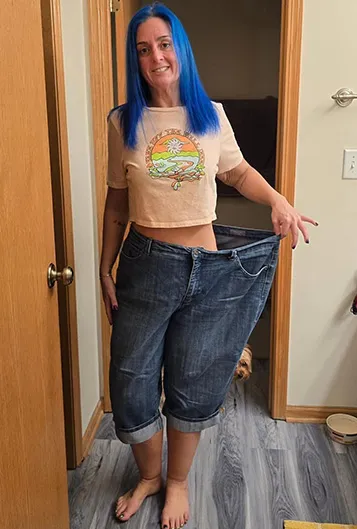 Michelle Wajda after bariatric surgery. 