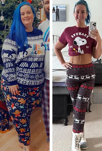 Michelle Wajda before and after Bariatric Surgery.